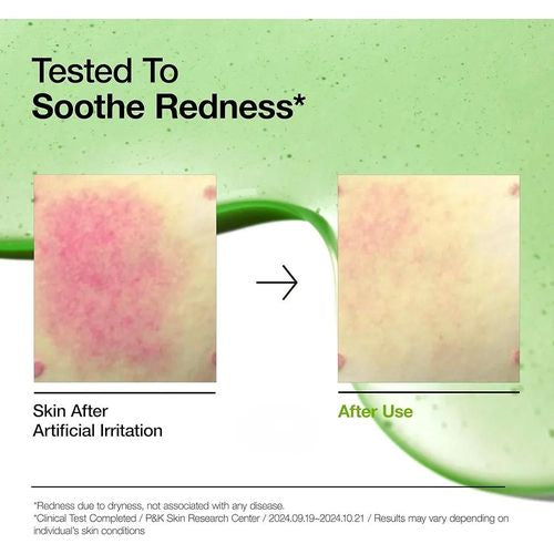 ANUA - 10+AZELAIC ACID 10 HYALURON REDNESS SOOTHING SERUM - 30ml